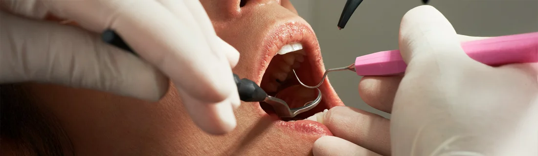 FC – Relaxed, Stress-Free Dental Care with Sedation Dentistry at Lincoln Park Center for Dental Anesthesia in  Chicago IL